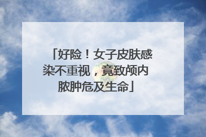 好险！女子皮肤感染不重视，竟致颅内脓肿危及生命