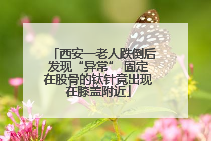 西安一老人跌倒后发现“异常” 固定在股骨的钛针竟出现在膝盖附近
